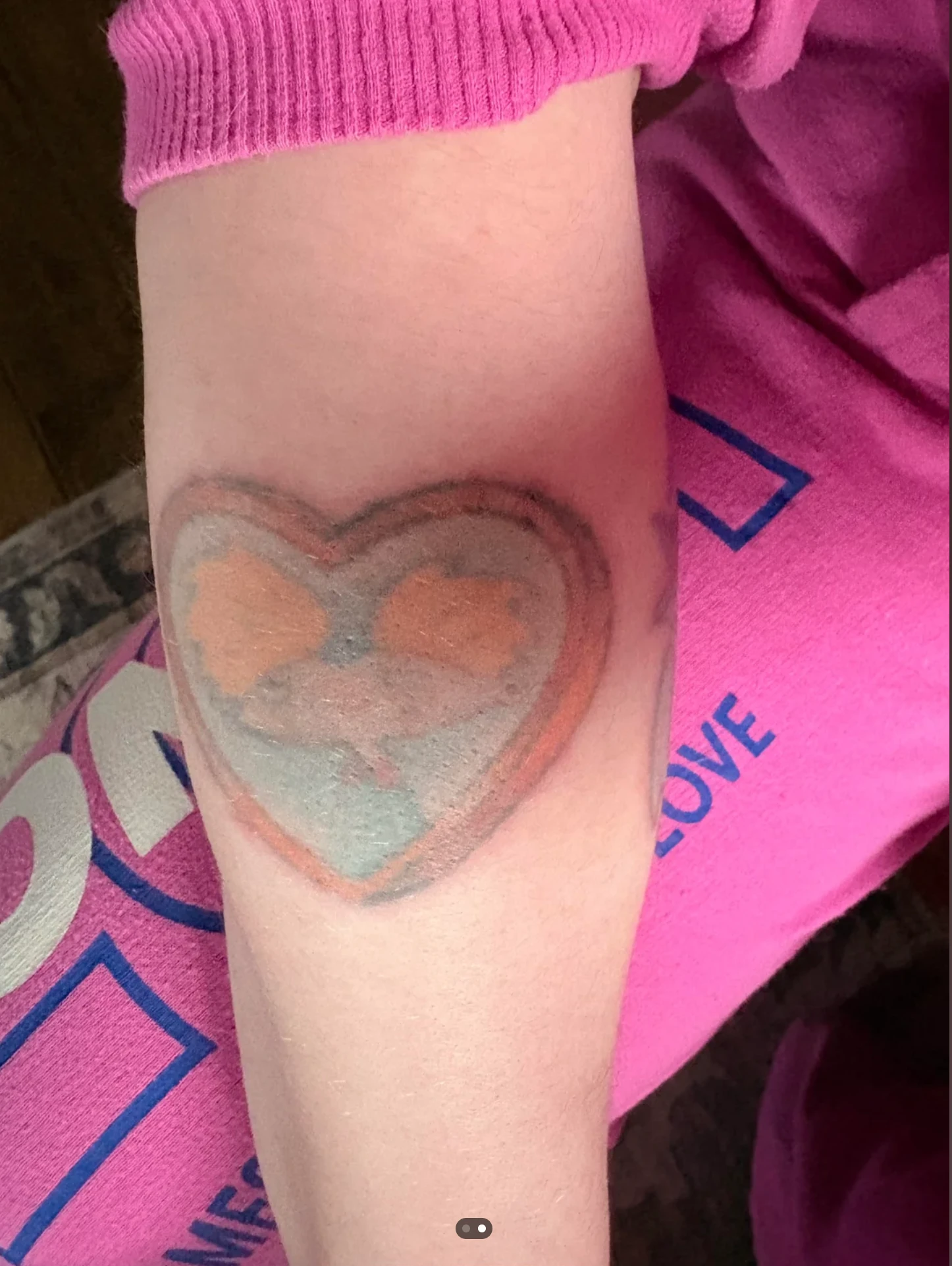 Small Blue And Yellow Tattoo on the Forearm After 3 Sessions: Minimal Visible Change So Far (25% Fading)