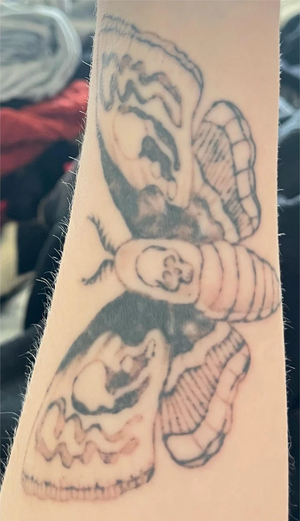 Black tattoo after 4 sessions