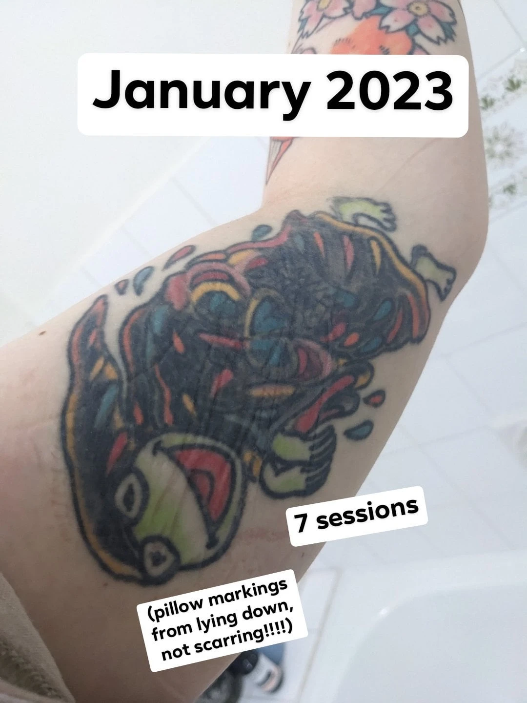 white tattoo after 10 sessions
