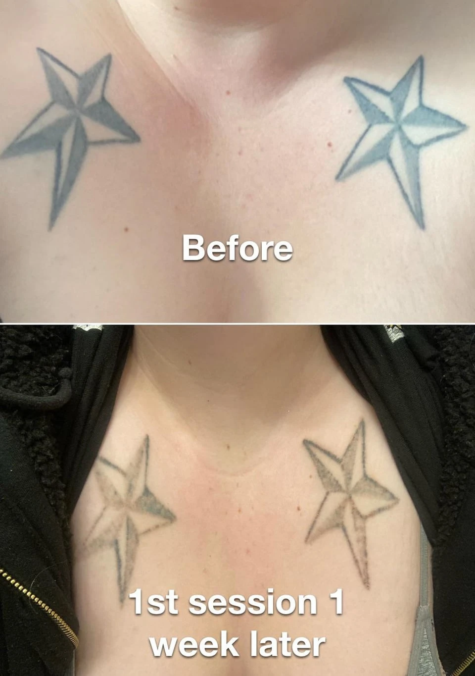 black tattoo after  sessions
