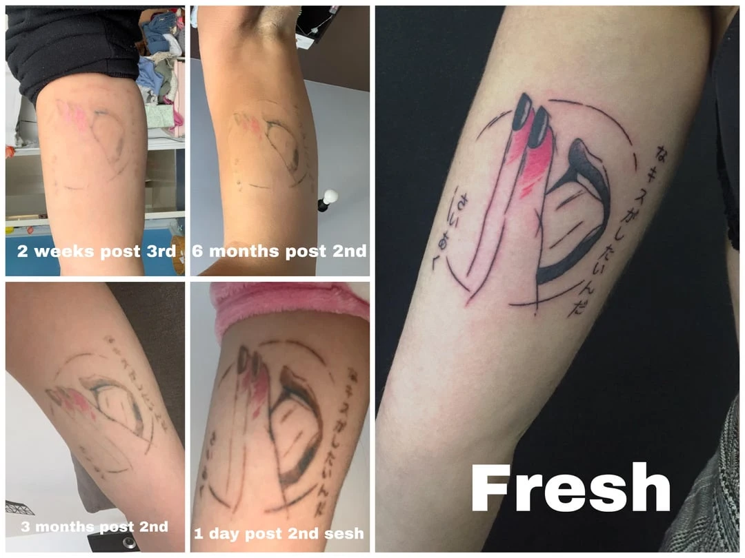 black and red tattoo before laser removal