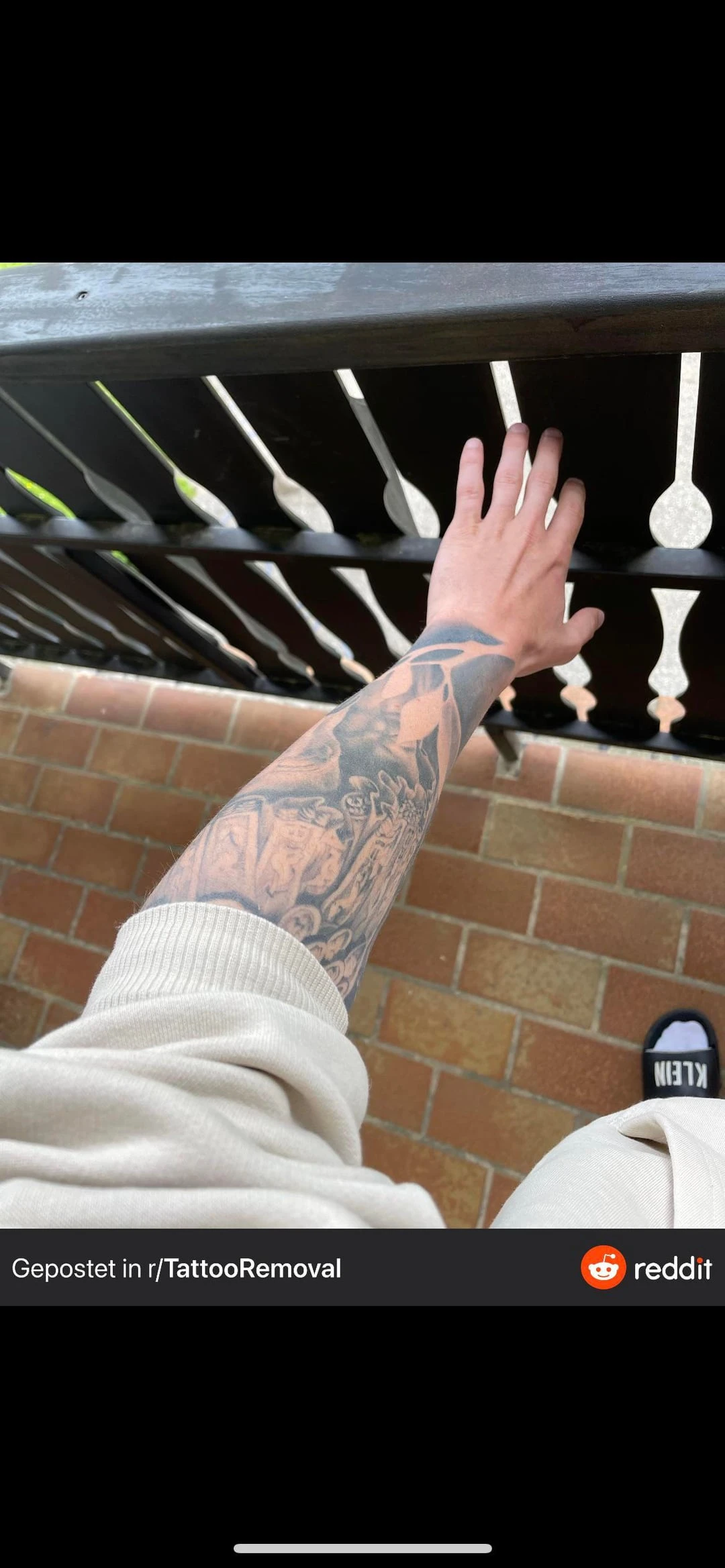 black tattoo before laser removal