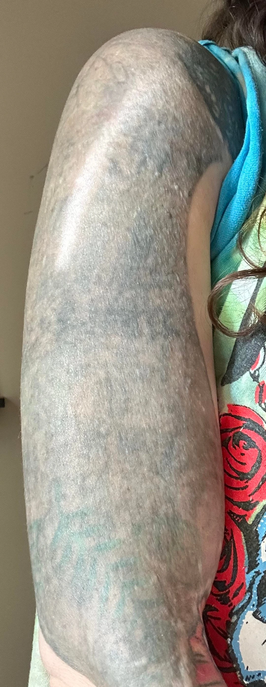 black tattoo after 30 sessions