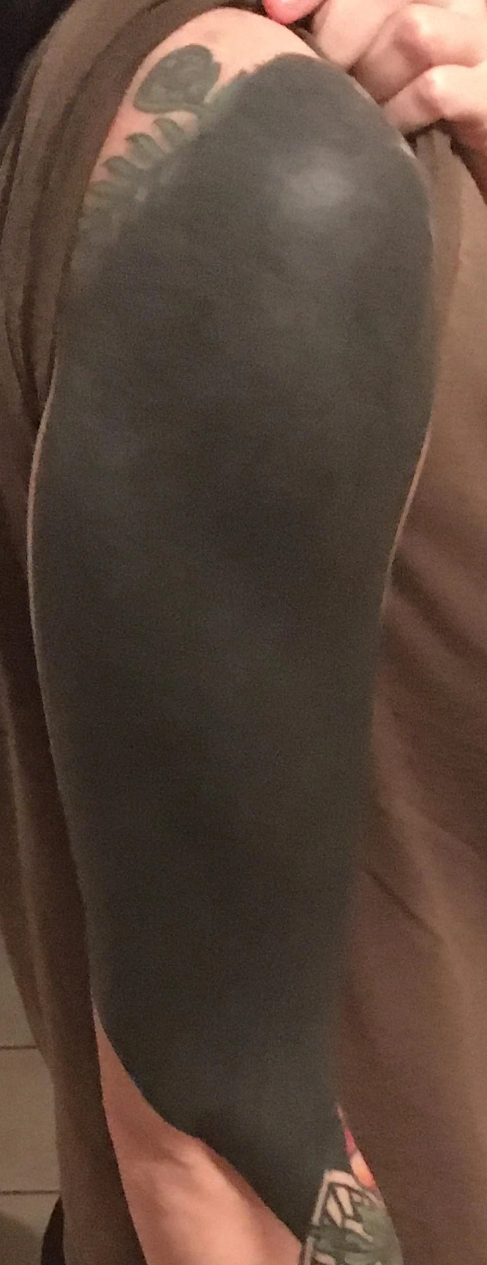 black tattoo before laser removal