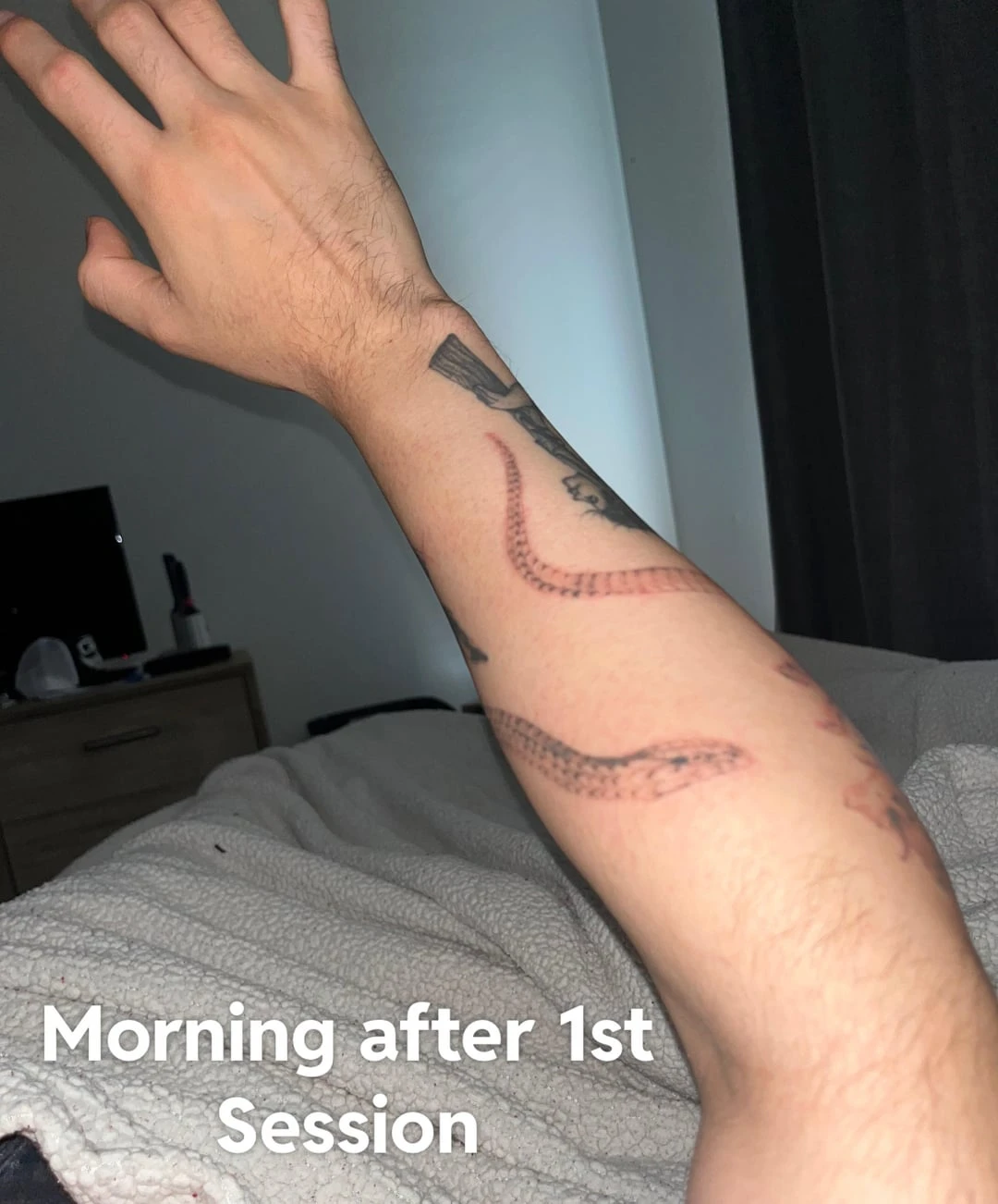 Black tattoo after 1 session