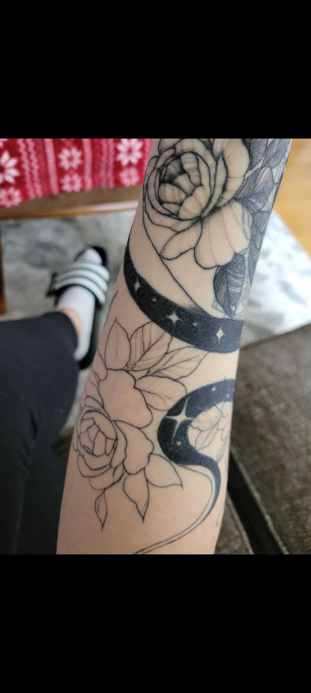 black tattoo before laser removal