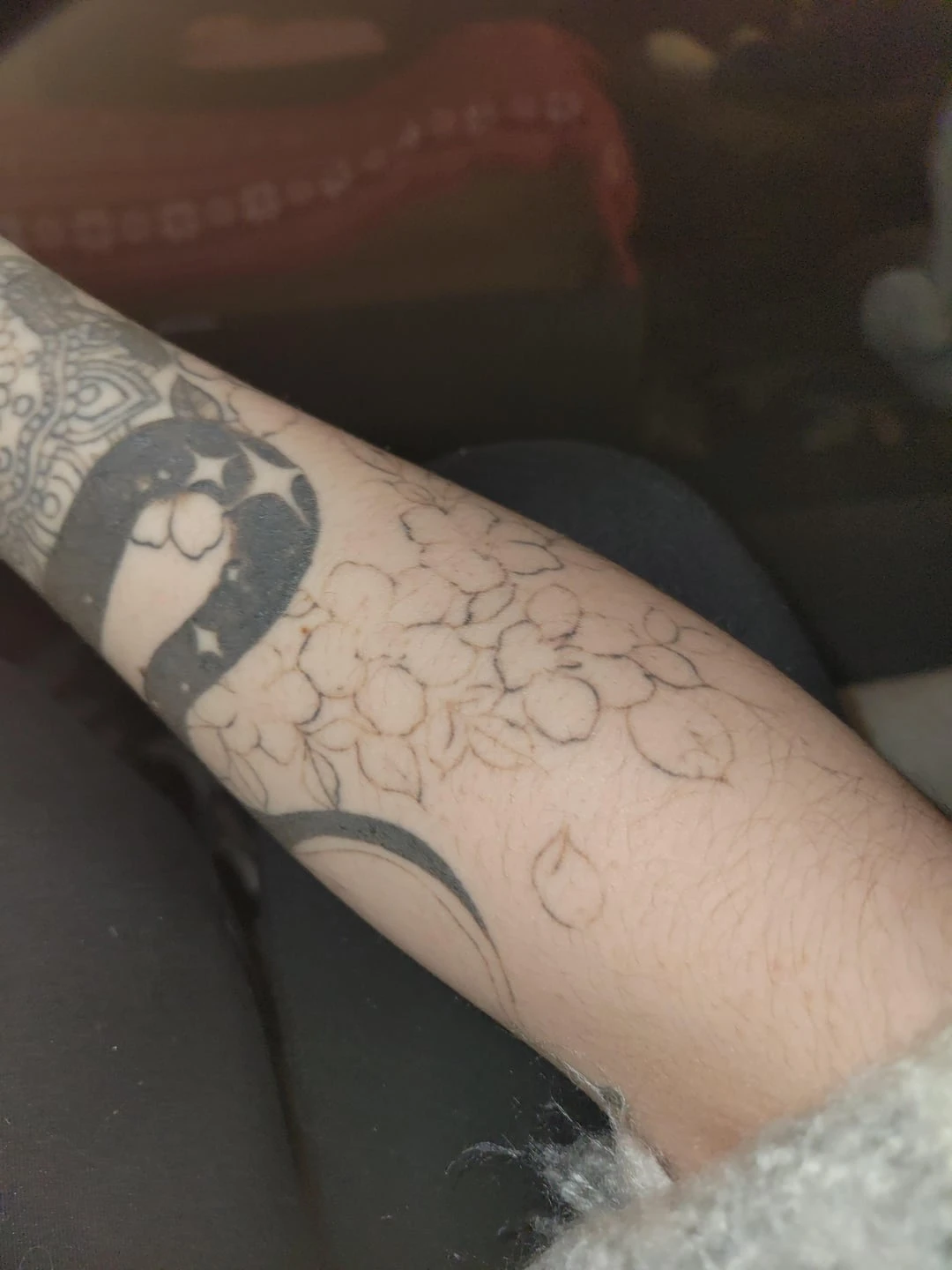black tattoo after 2 sessions
