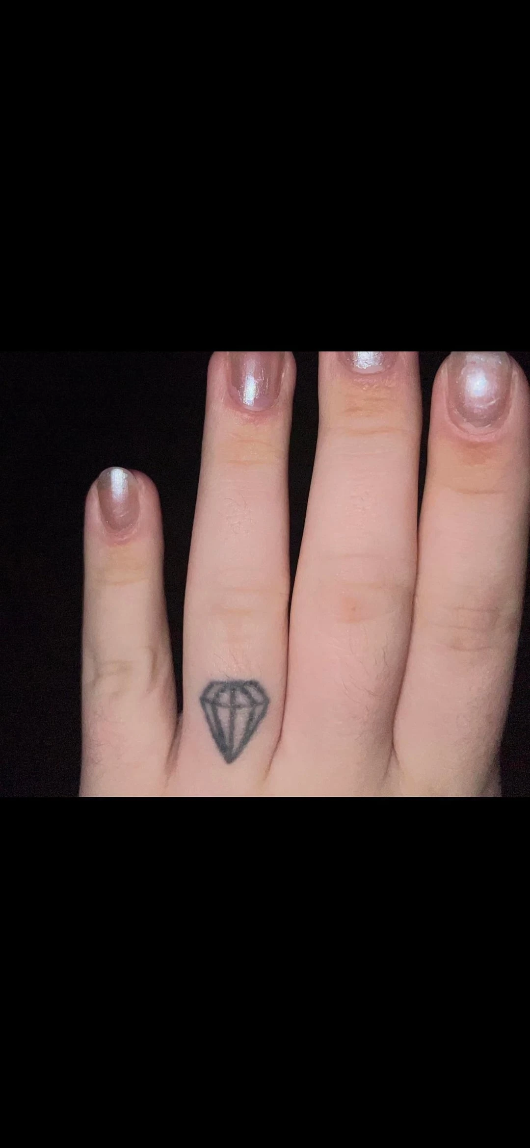 black tattoo after 1 sessions