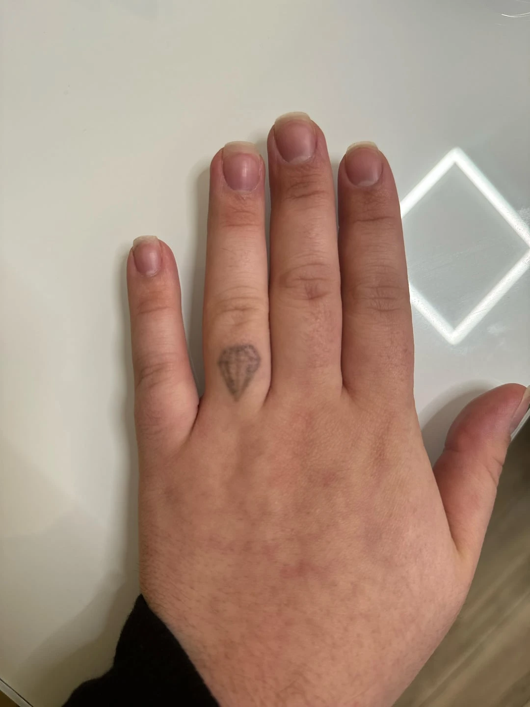 black tattoo before laser removal