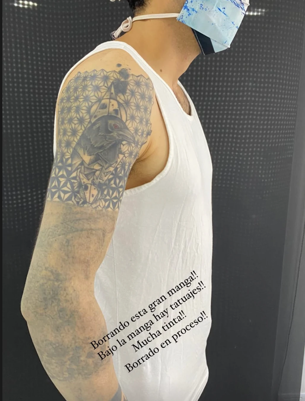 Black tattoo after 4 sessions