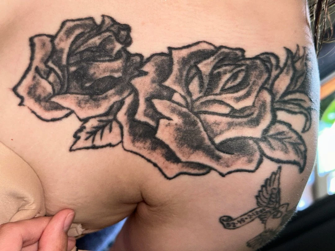 red tattoo before laser removal