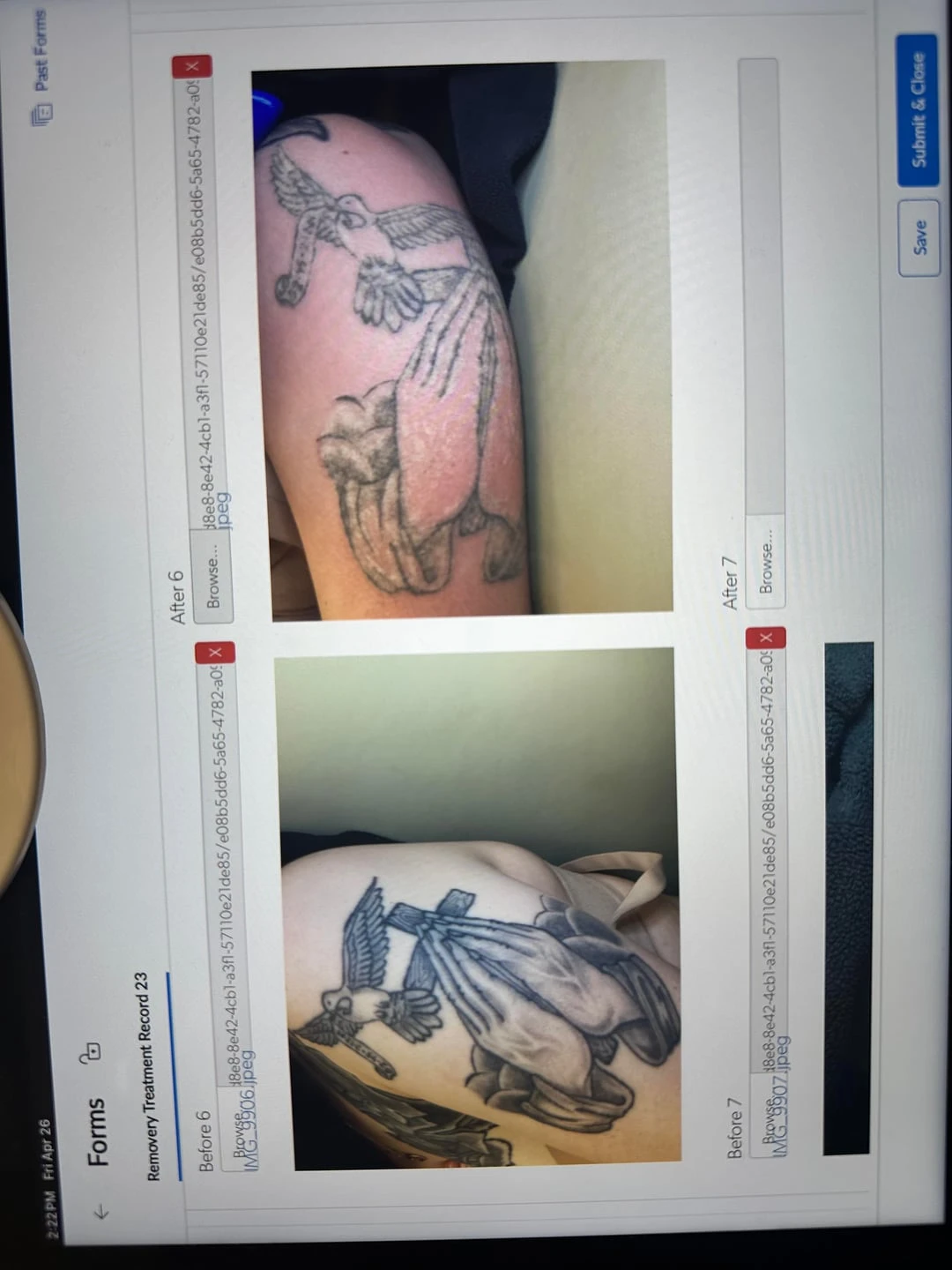 red tattoo after 1 sessions
