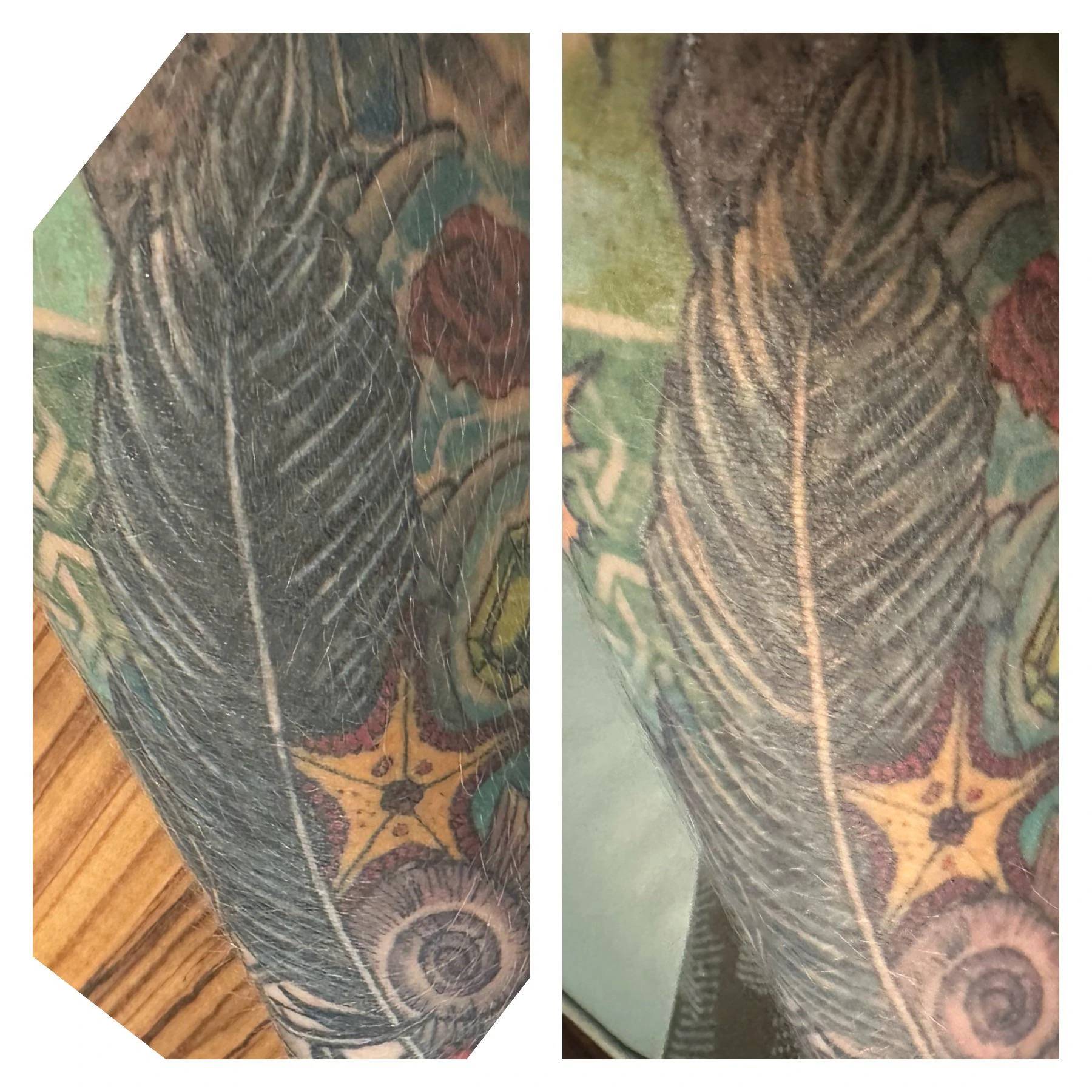 black and white tattoo before laser removal