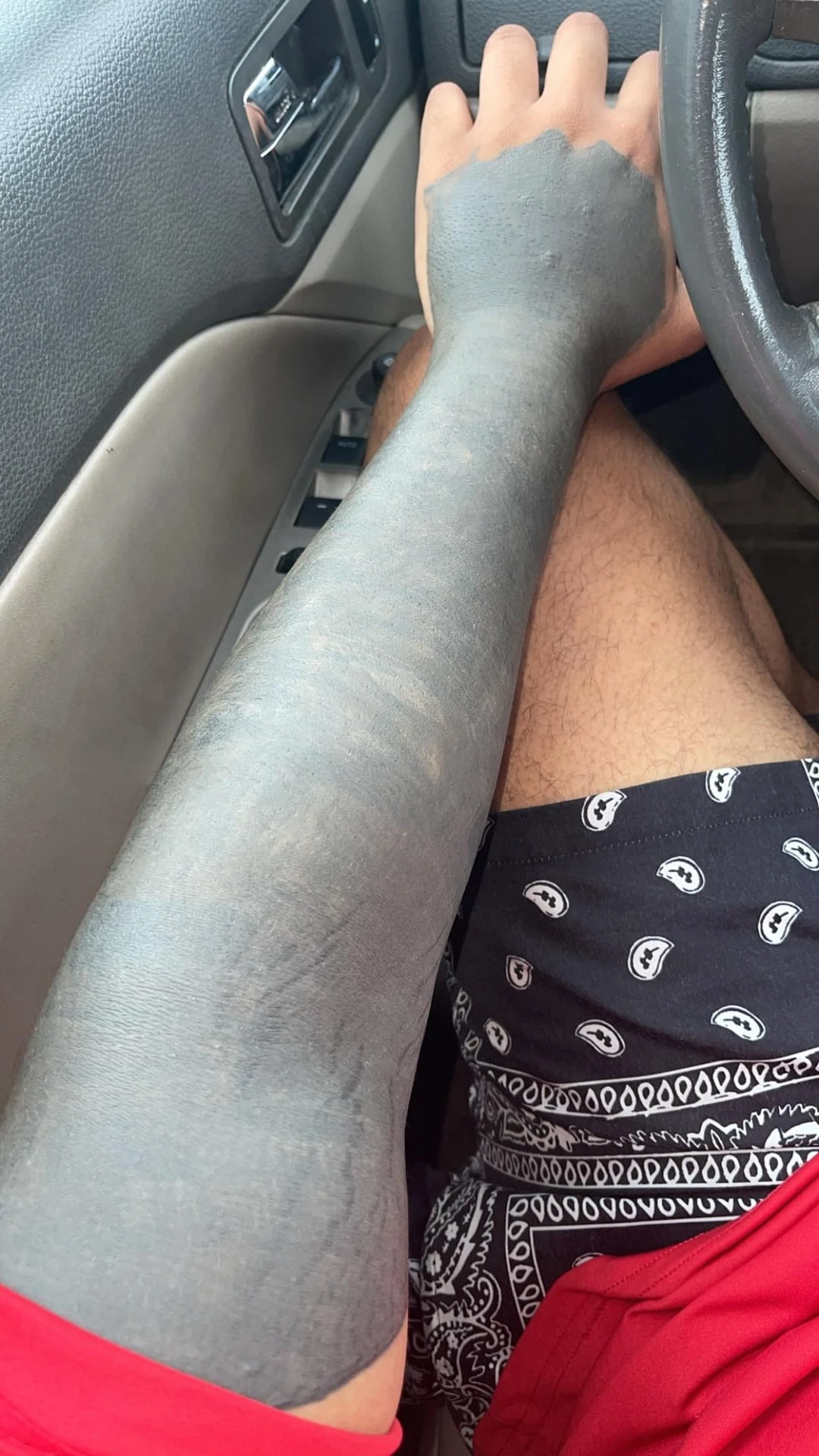 black tattoo after 1 sessions