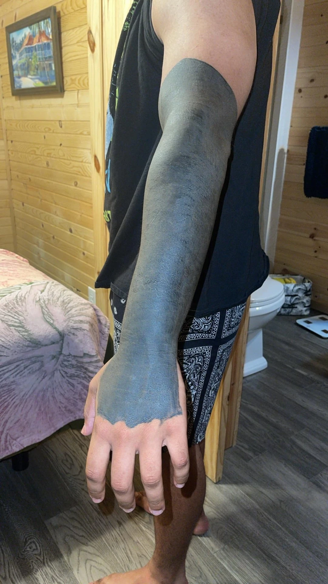 black tattoo before laser removal