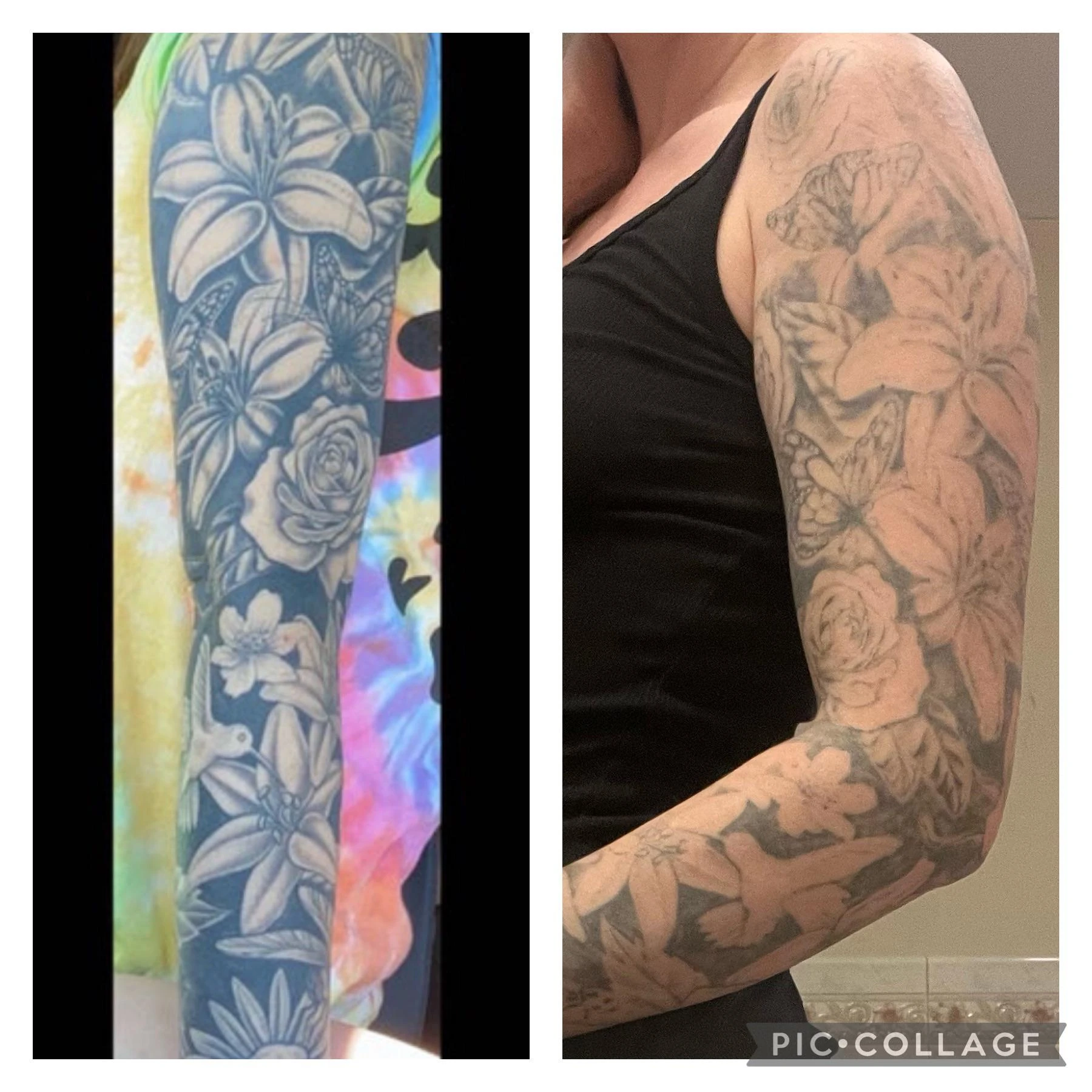 black tattoo before laser removal