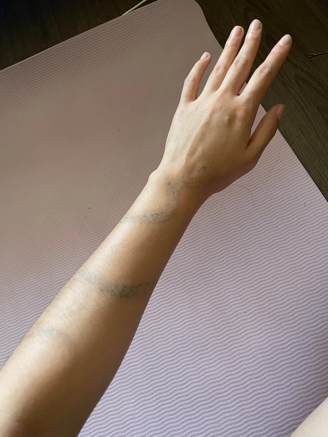 Black tattoo after 4 sessions