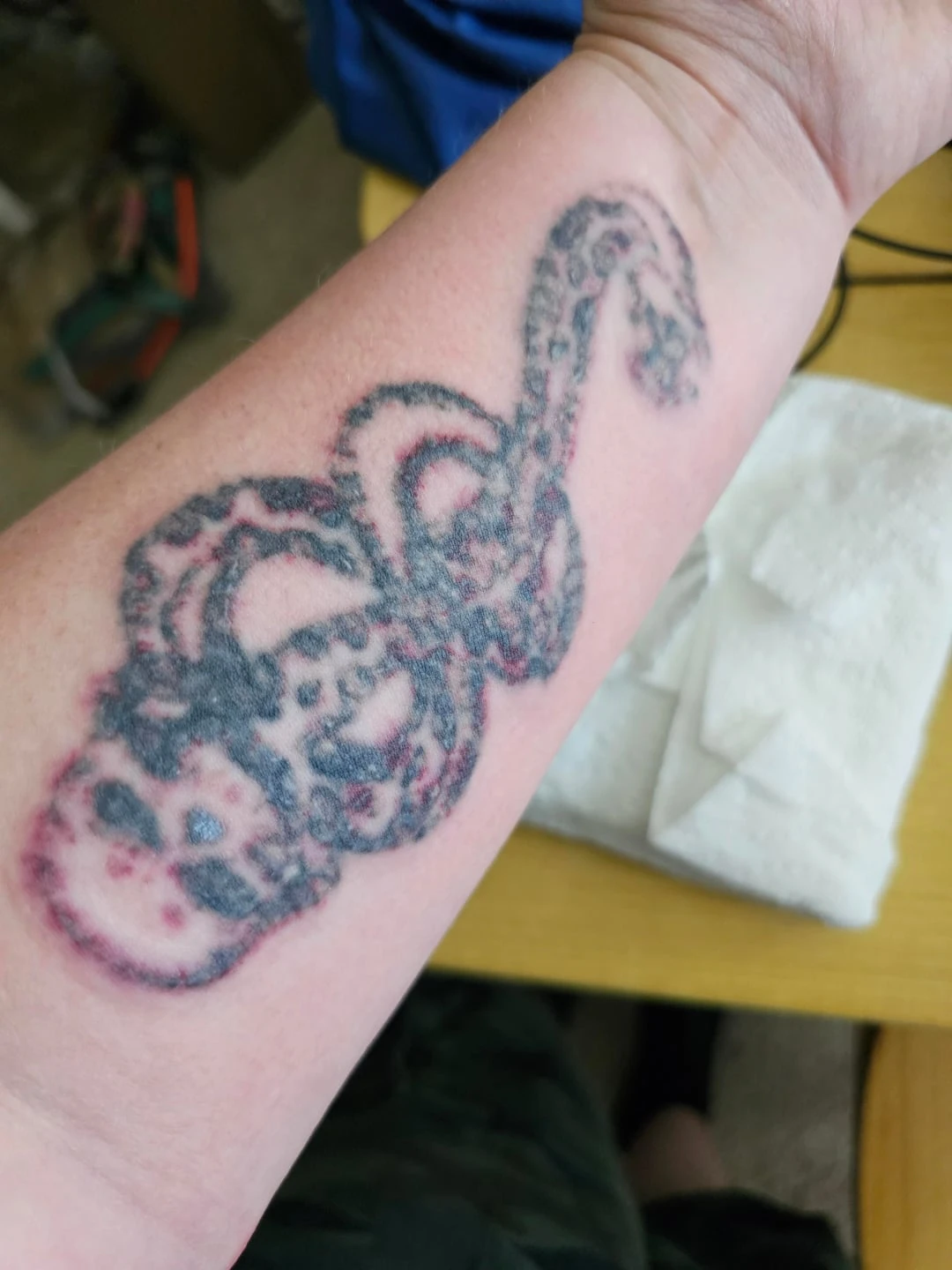 black tattoo after 1 sessions