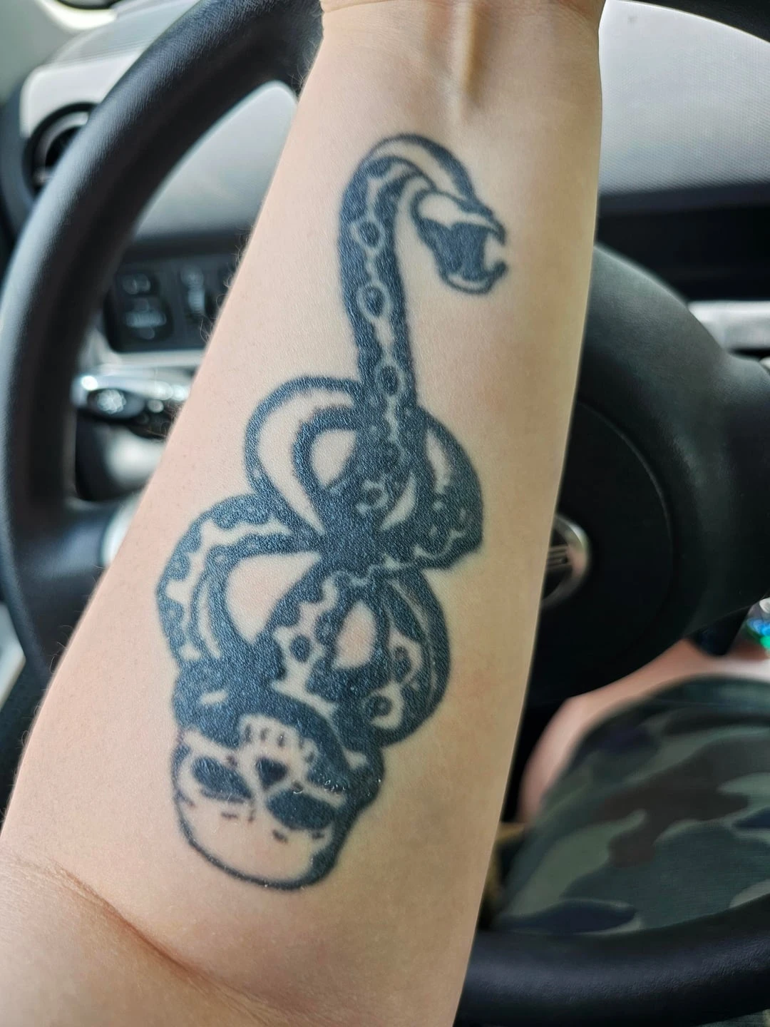 black tattoo before laser removal