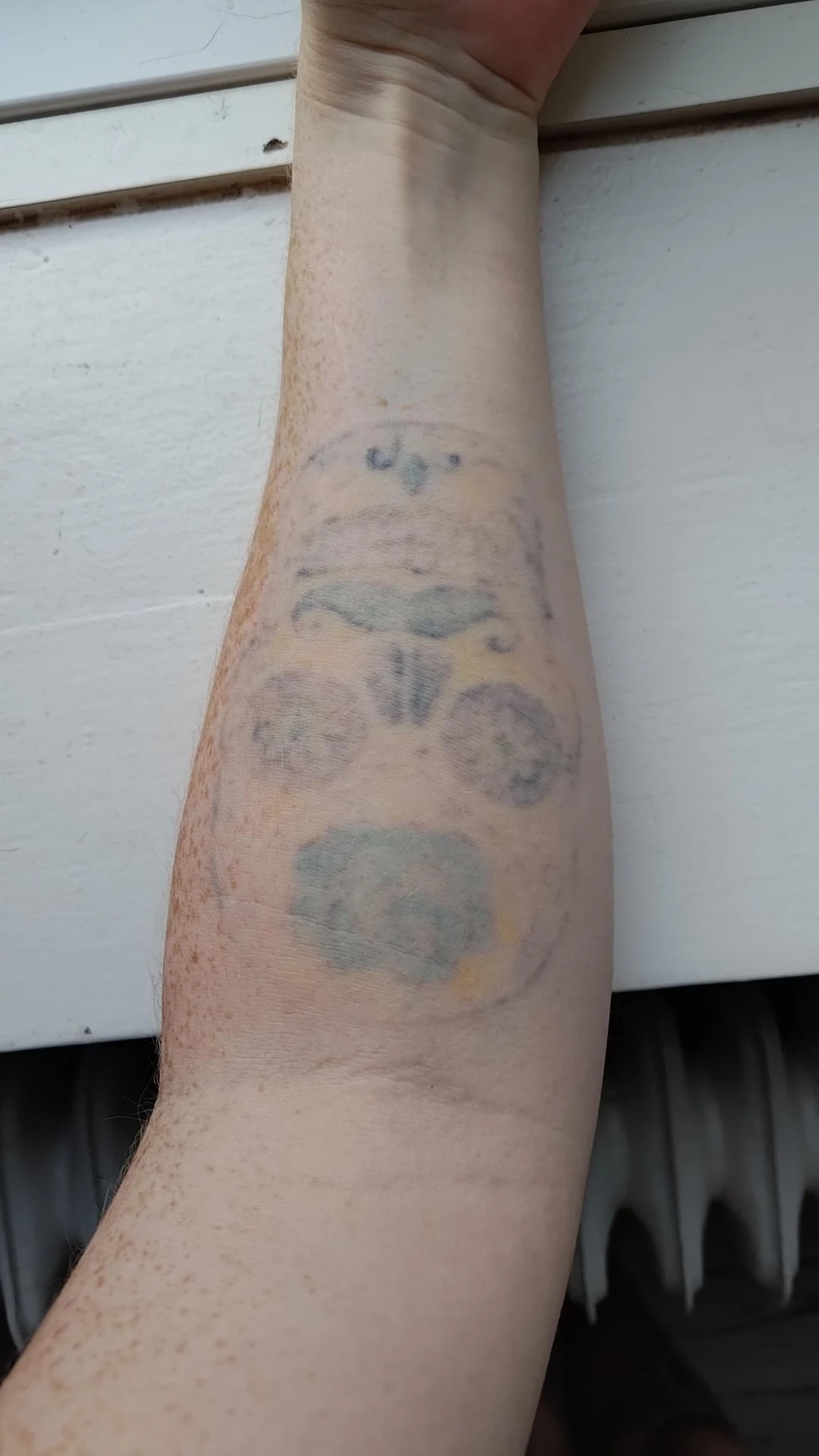 black, blue, green and yellow tattoo after 10 sessions