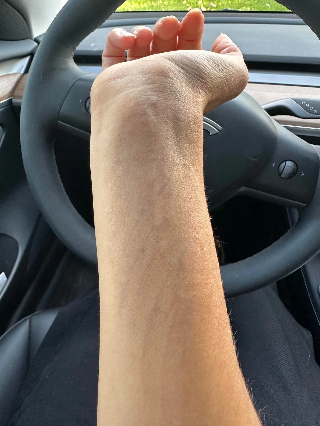 black tattoo after 8 sessions