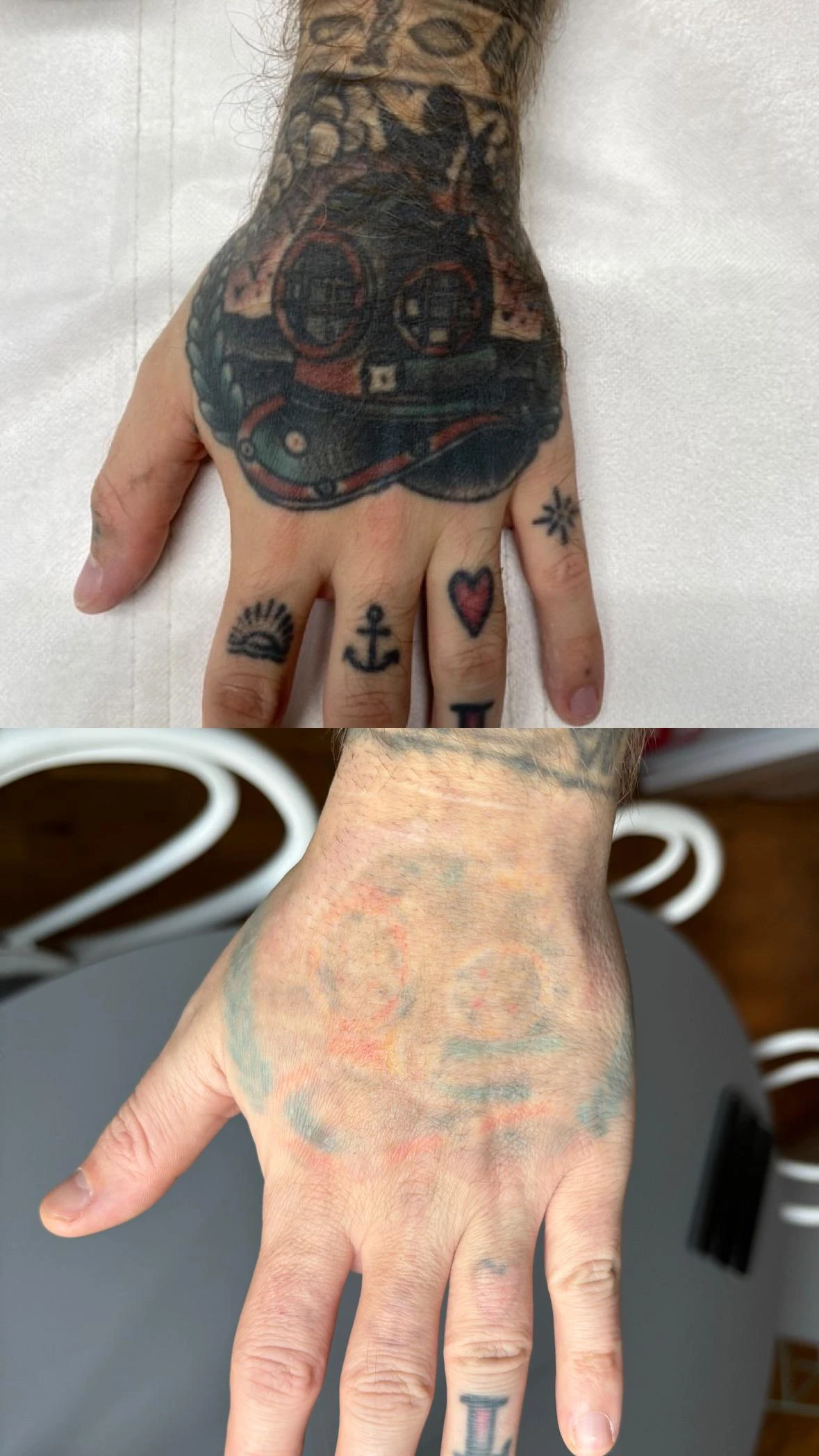black, red and green tattoo before laser removal