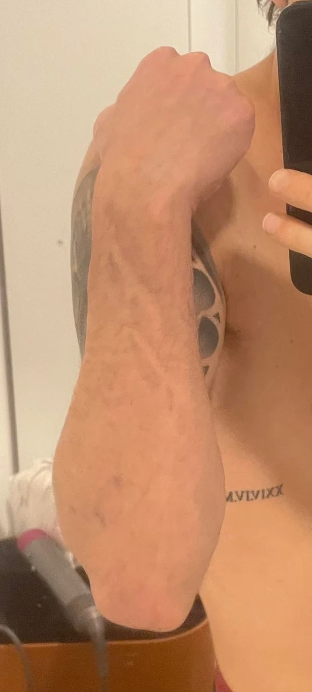 red tattoo after 10 sessions