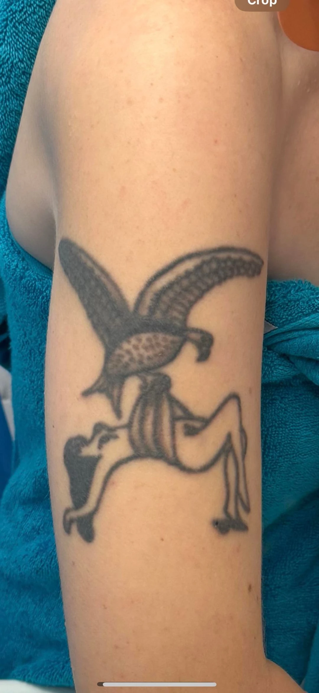 black tattoo after 5 sessions