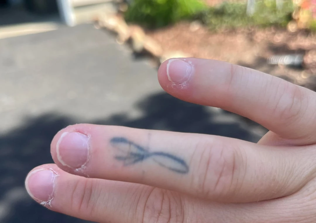 black tattoo after 2 sessions