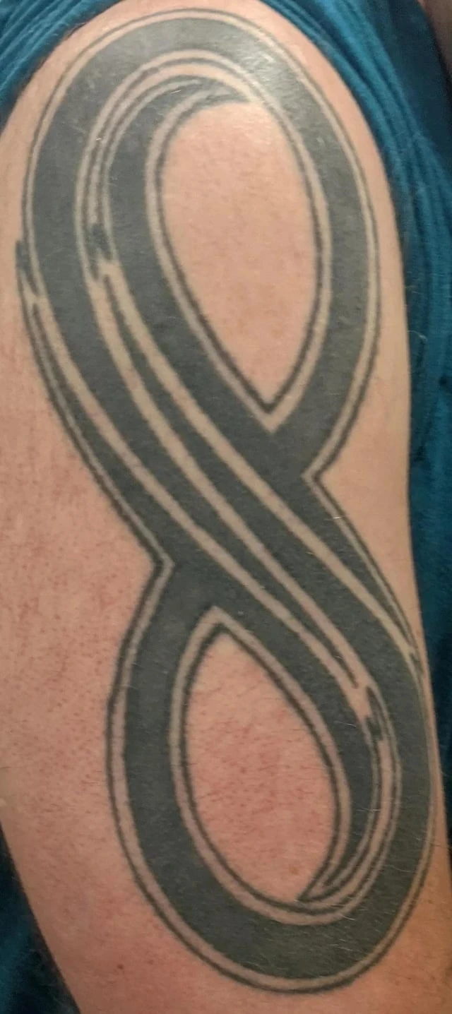 black tattoo before laser removal