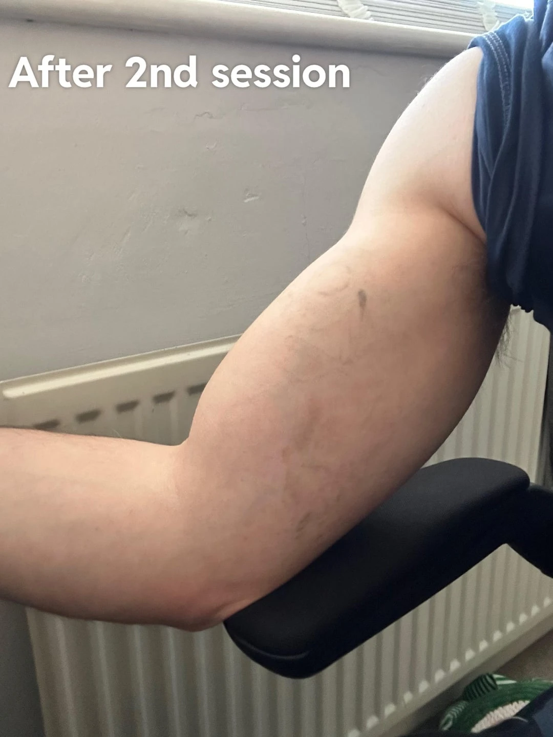 black tattoo after 2 sessions