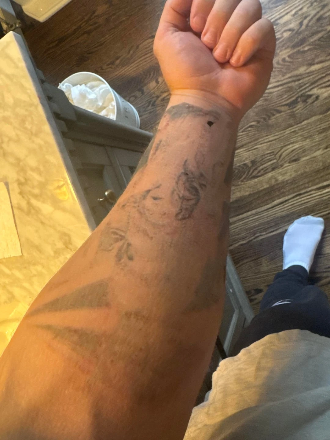 Black tattoo after 1 session