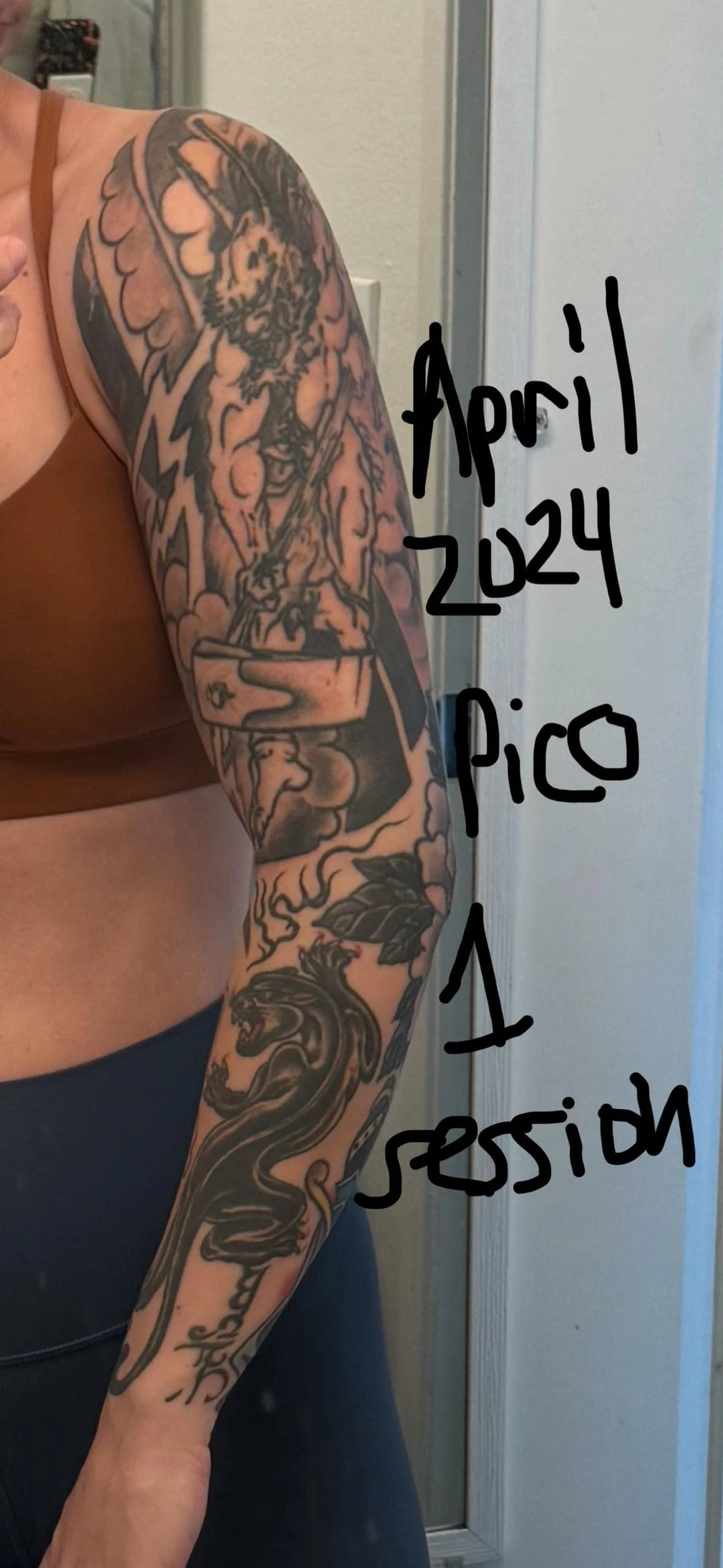 black tattoo before laser removal