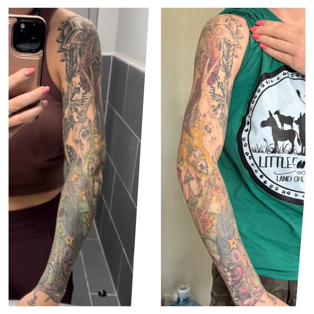 black tattoo after 7 sessions