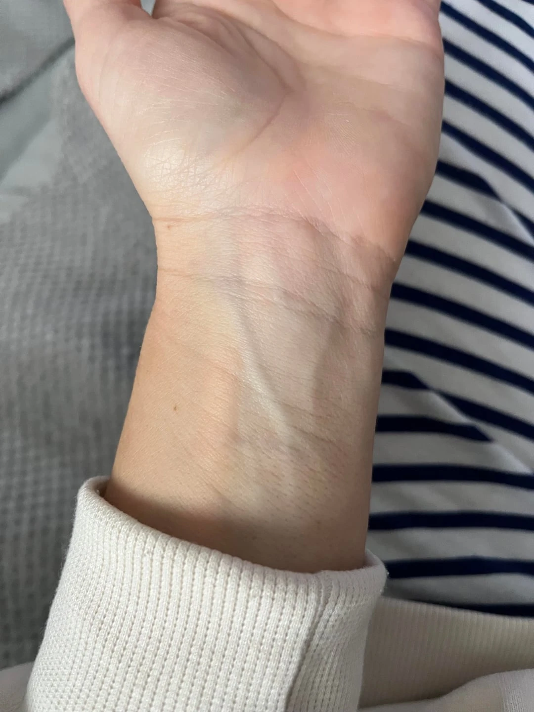 Black tattoo after 9 sessions