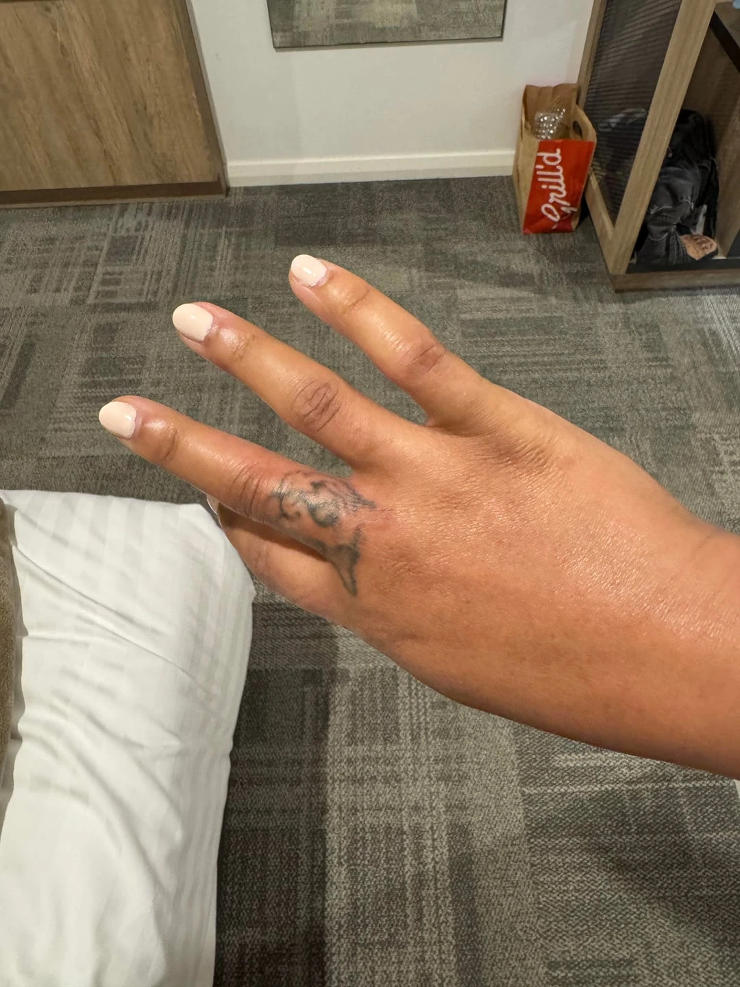 black tattoo after 2 sessions