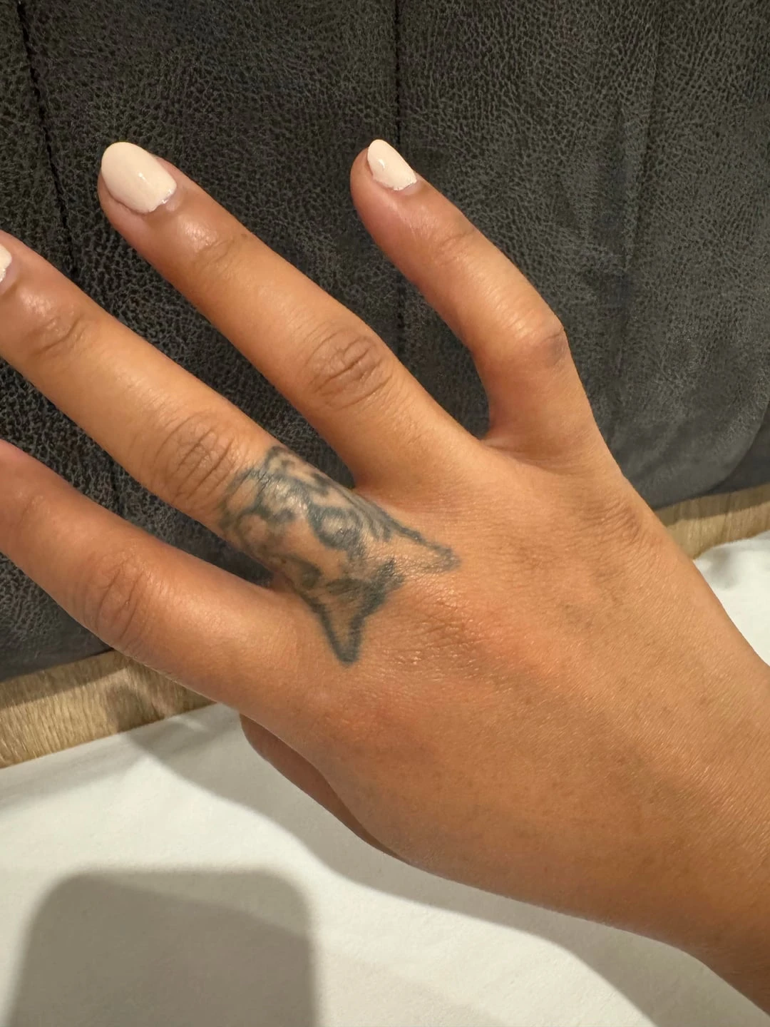 black tattoo before laser removal