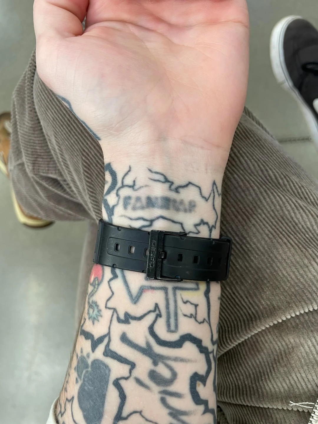 Multicolor tattoo session 7 laser tattoo removal