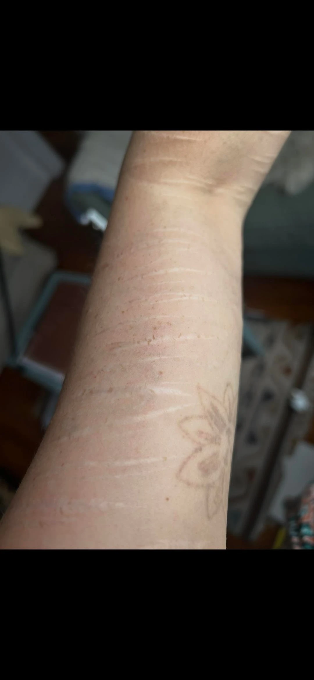 black and red tattoo after 8 sessions