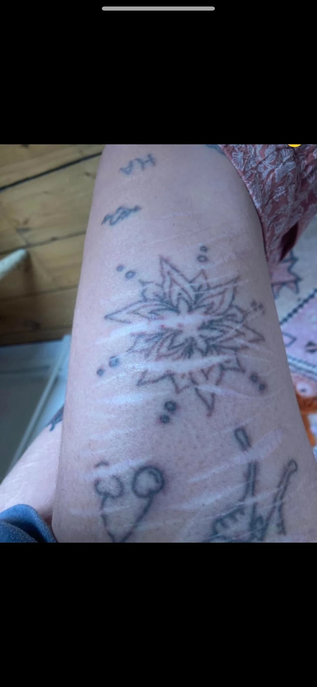 black and red tattoo before laser removal