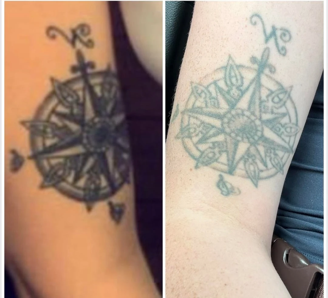 black and white tattoo after 5 sessions