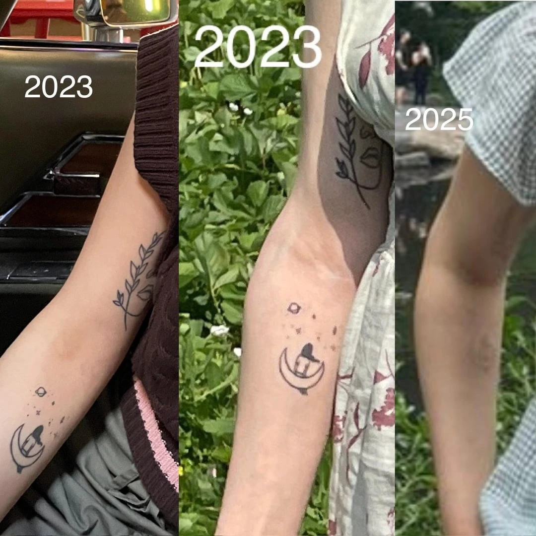 black tattoo before laser removal