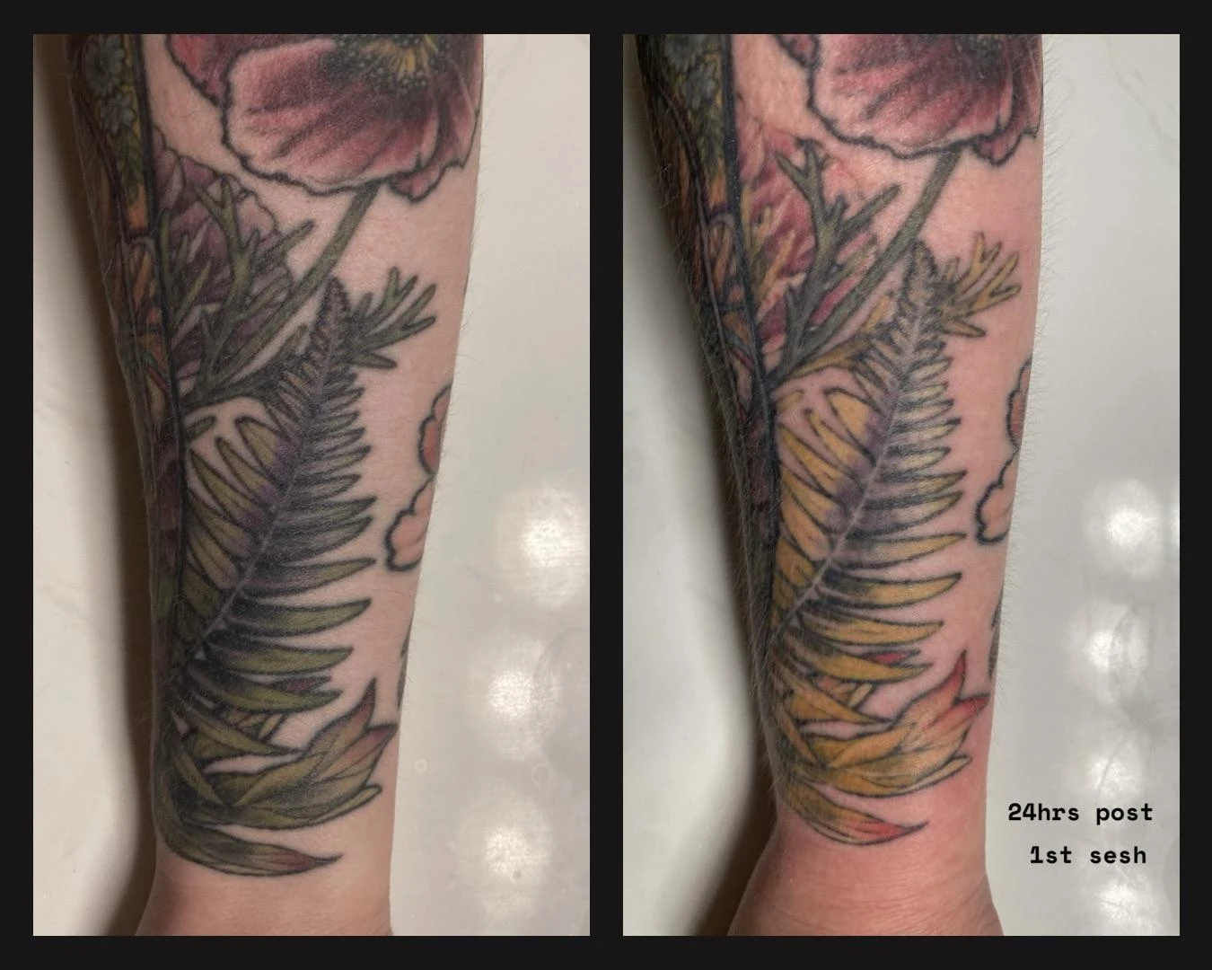 green, purple, yellow and black tattoo before laser removal