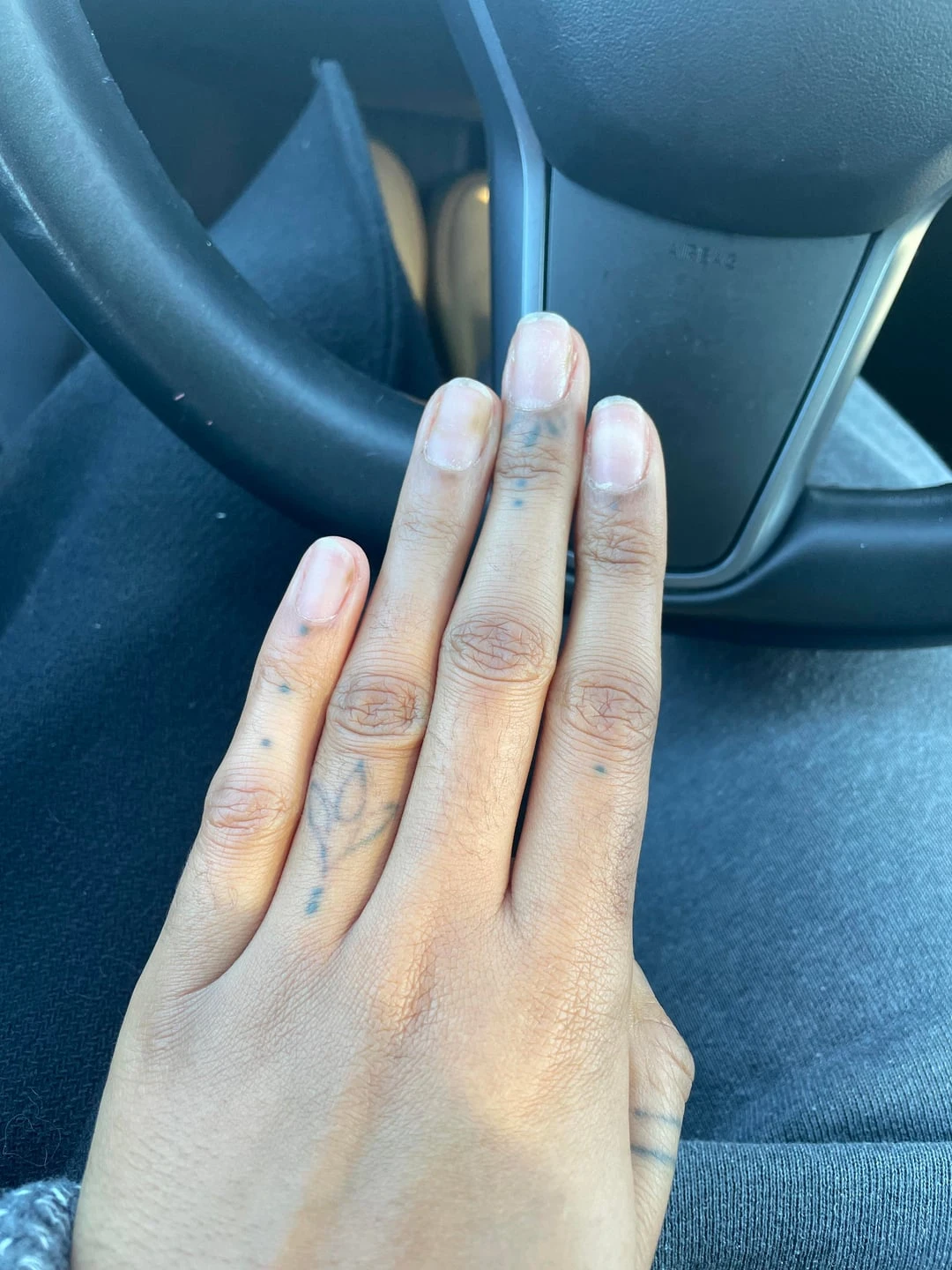 black tattoo before laser removal
