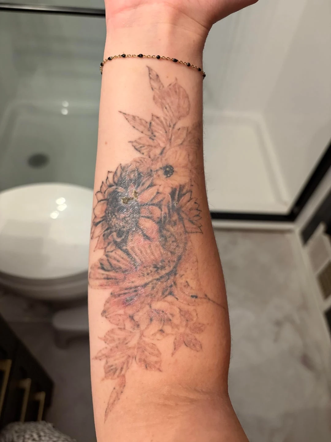 Black tattoo after 1 session