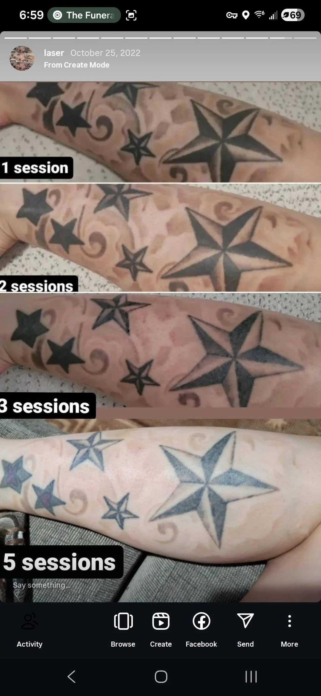 black tattoo after 9 sessions
