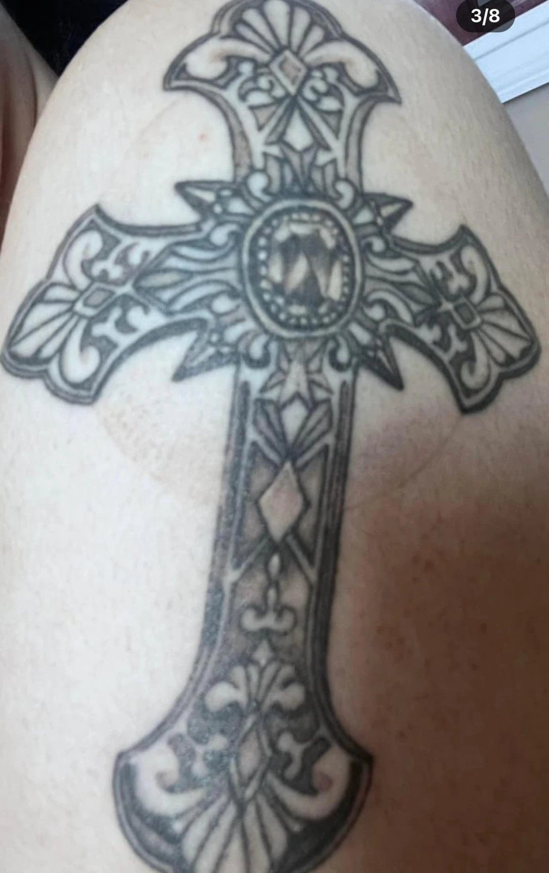 White And Black tattoo session 1 laser tattoo removal