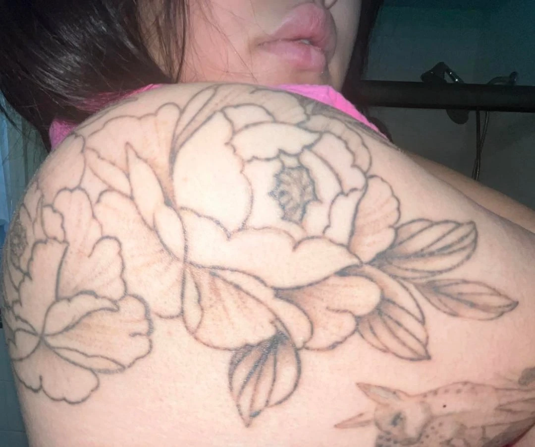 Medium White And Black Tattoo: 50% Fading After 6 Sessions at Removery ($4,000)