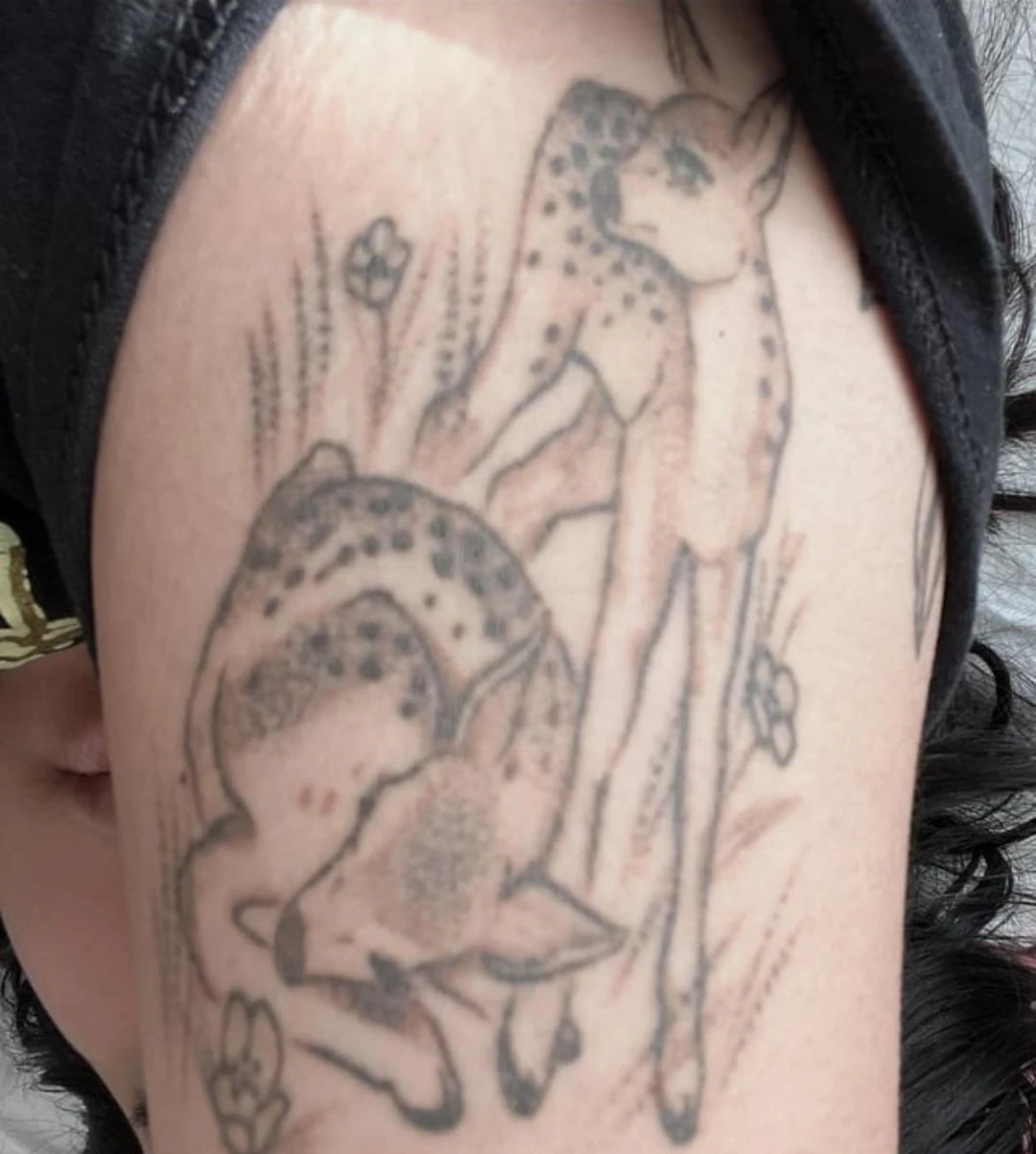White And Black tattoo session 1 laser tattoo removal