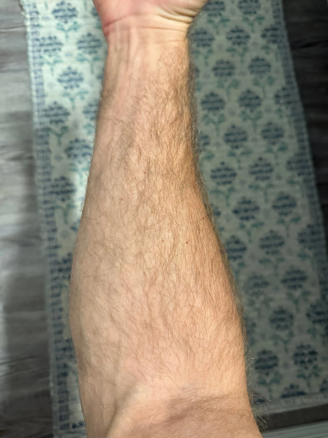 black tattoo after 10 sessions